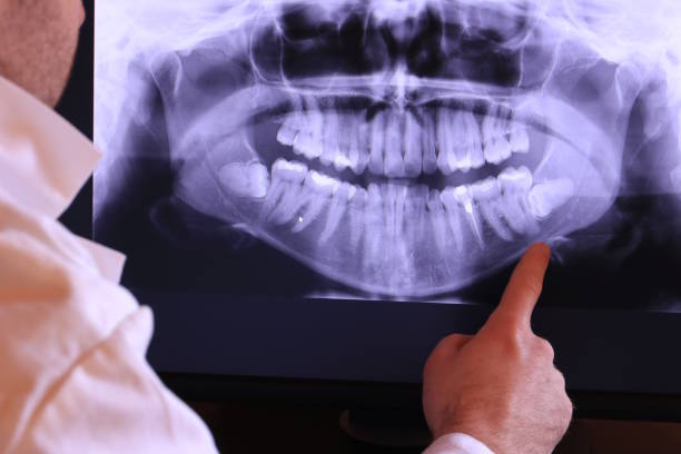 Best Emergency Care for Gum Disease in Lakes Of The Four Seasons, IN