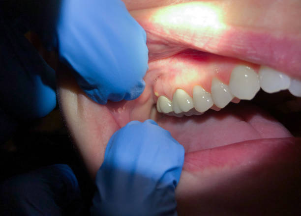 Best Emergency Treatment for Jaw Pain or Injury in Lakes Of The Four Seasons, IN